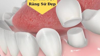 Top 10 Địa Chỉ Bọc Răng Sứ Đẹp Và An Toàn Nhất TPHCM